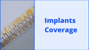 Dental-Plans-Implant-Coverage