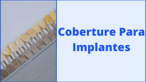 Planes-Dentales-Cobertura-de-Implantes